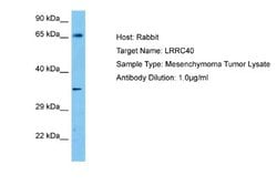 LRRC40 Rabbit anti-Human, Polyclonal, Novus Biologicals 0.1ml; Unconjugated:Antibodies,